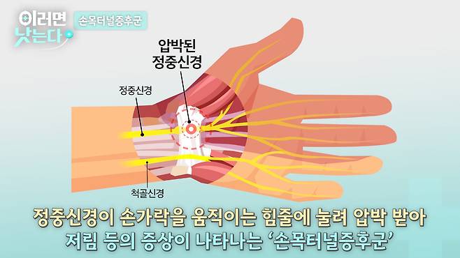 /조선일보 의학·건강 유튜브 '이러면 낫는다'