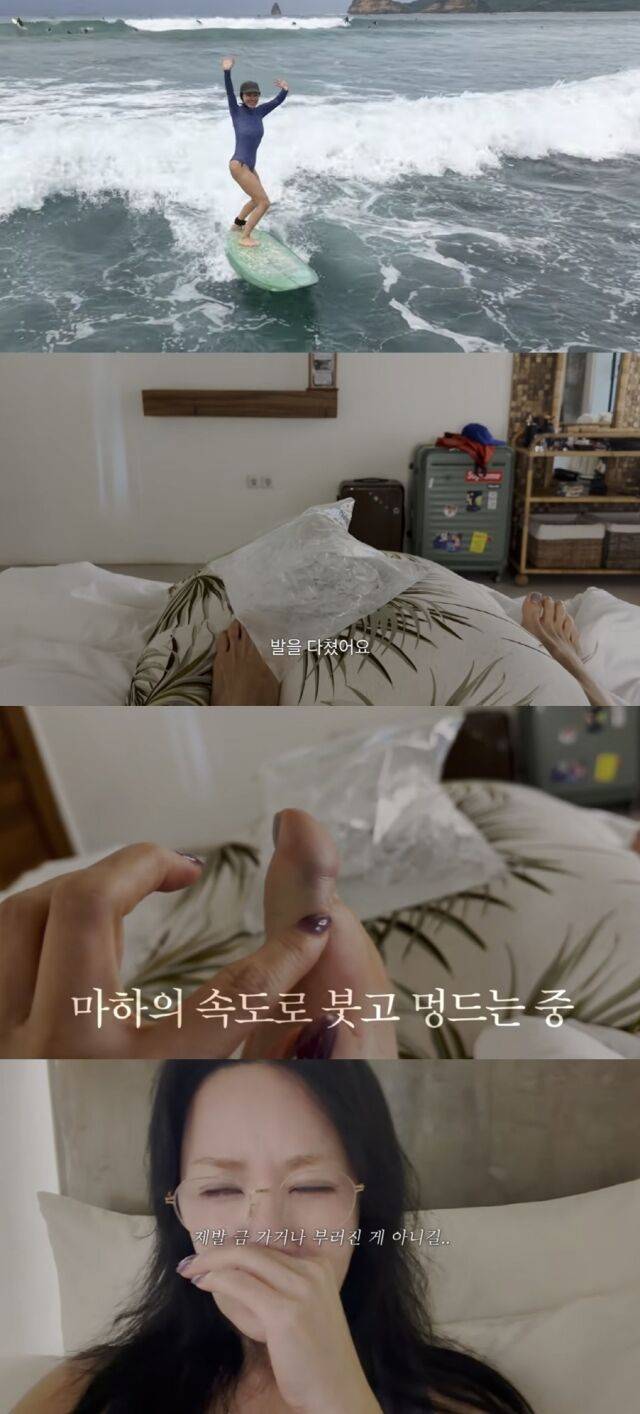 가수 겸 배우 엄정화가 정재형 등 지인들과 떠난 서핑 여행 중 예기치 못한 부상을 당해 안타까움을 자아냈다./유튜브 채널 'Umaizing 엄정화TV'