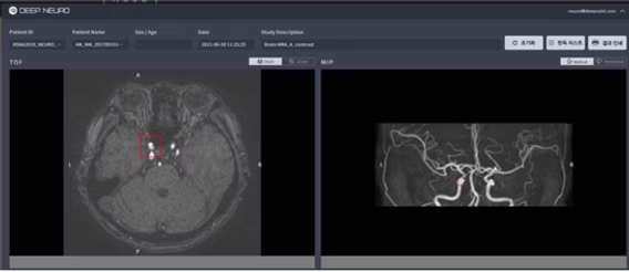 딥노이드 제품 모습 (사진=딥노이드)