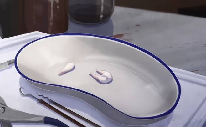 애니메이션 영화 ‘티스(Teeth)’에서 주인공은 빠진 이에 대해 과도한 집착을 보인다. Alter 제공