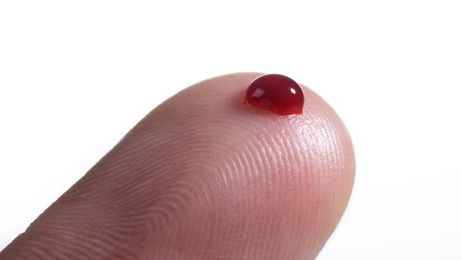 무릎 관절염이 당뇨병 환자의 혈당 조절에 영향을 미친다는 연구 결과가 나왔다｜출처: 클립아트코리아