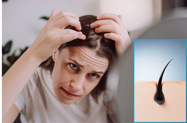 머리카락이 단순히 밀려 자라는 것이 아니라, 모낭 내부에서 움직이는 세포들이 작은 모터처럼 작용해 모발을 위로 '끌어당기는' 방식으로 성장할 수 있다는 연구 결과가 나왔다. 사진=게티이미지뱅크 편집