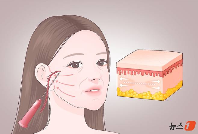 '복합 시술'은 에너지 기술로 구조를 정비하고 스킨부스터로 수분 환경을 채우는 원리라고 할 수 있다. 에너지 디바이스 기반 시술과 히알루론산 제제는 서로 다른 층위에서 피부 상태를 보완함으로써 보다 자연스럽고 조화로운 결과를 기대할 수 있다. ⓒ 뉴스1 윤주희 디자이너
