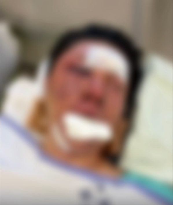 유튜버 수탉 본인이 납치사건 이후 공개한 사진. 숲 라이브 방송 캡처