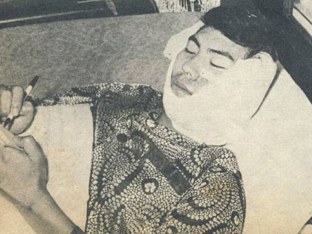 나훈아는 1972년 무대에서 피습당해 왼쪽 뺨을 72바늘이나 꿰매야 했다. 자료사진