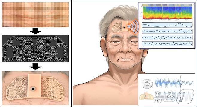 주름 따라 움직이는 EEG 패치 모식도(충남대학교 제공.재판매 및 DB금지)/뉴스1