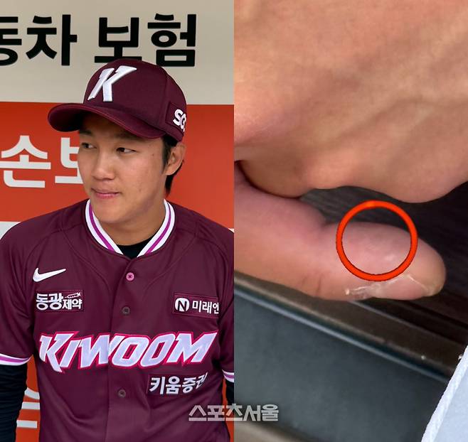 안우진의 중지 손가락에 보이는 굳은살과 물집. 대전 | 박연준 기자 duswns0628@sportsseoul.com