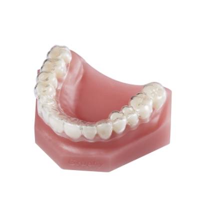 치아에 그래피의 SMA를 끼웠을 때의 모습 (사진=그래피)