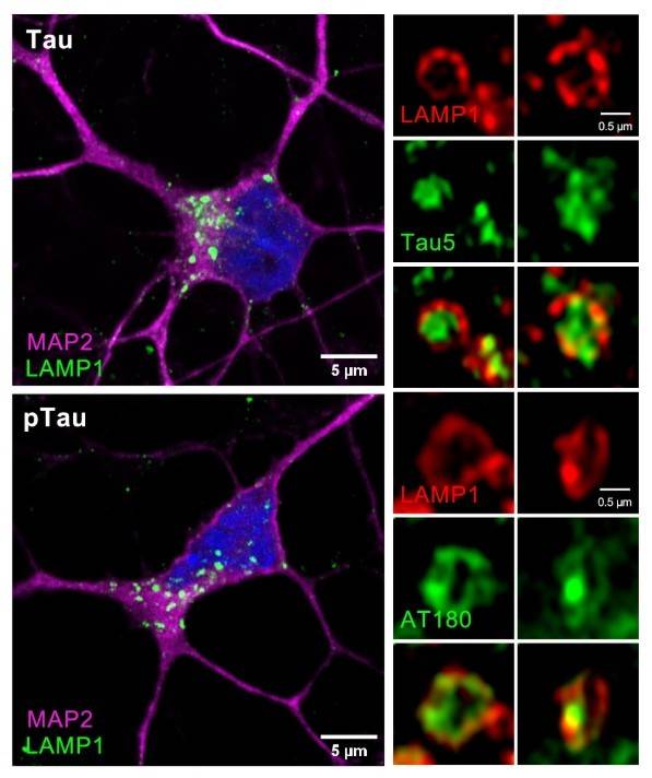 A pathogenic Tau mutation drives autophagy-lysosome dysfunction that limits Tau degradation in a model of frontotemporal dementia. Nat Commun17 (2026)