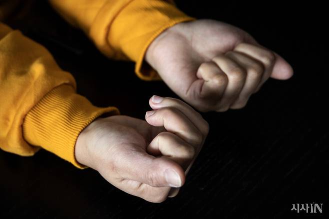 이주노동자 안셀 씨는 굴 까기 작업을 한 이후 오른손의 세 번째, 네 번째 손가락이 잘 굽혀지지 않는다고 토로했다. ⓒ시사IN 박미소