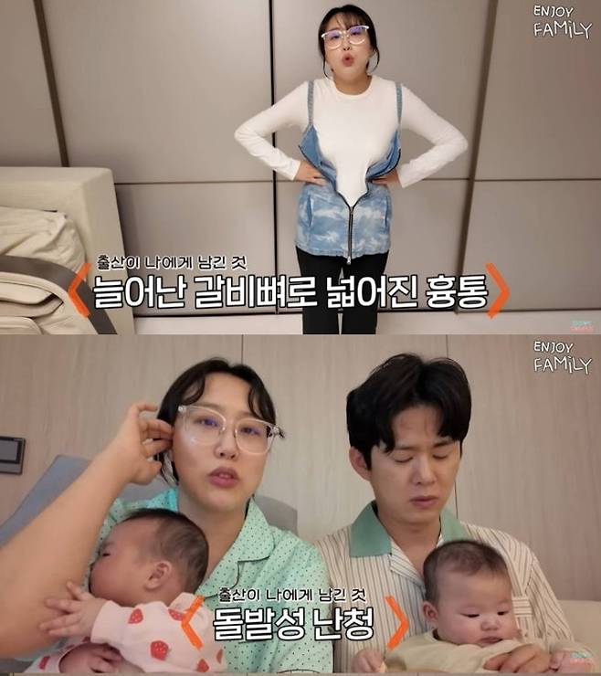 임라라가 출산 이후 넓어진 흉통과 돌발성 난청 등 신체 변화를 털어놨다. 유튜브 채널 ‘엔조이커플’ 캡처