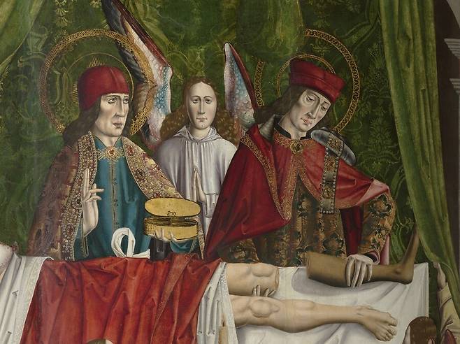 3세기 기독교 성인 코스마스와 다미안 형제가 다리 이식 수술로 기적적인 치료를 행하는 모습을 그린 유럽 중세의 유화. 위키미디어 코먼스