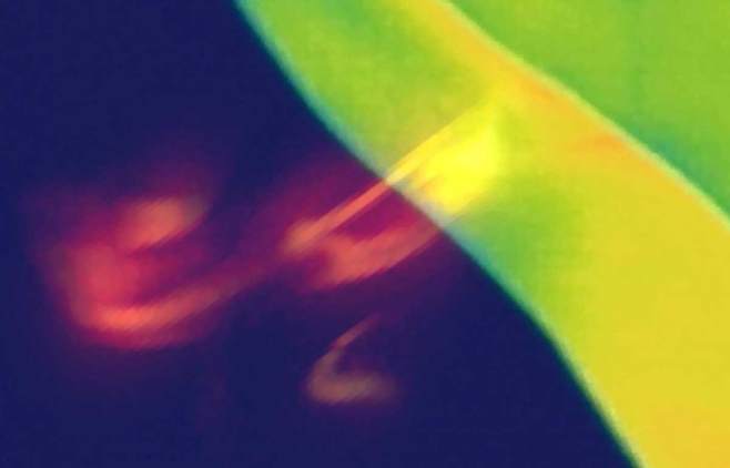 방귀를 오래 참으면 장 질환이 생길 수 있다. /클립아트코리아