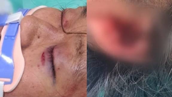 김창민 감독이 폭행 당한 뒤 병원에 입원한 모습[JTBC 캡처]