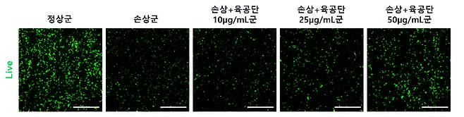 과산화수소 처리로 감소한 해마 신경세포 생존율이 과산화수소와 육공단으로 동시 처리한 결과 육공단 투여 농도에 따라 생존율이 증가했다.(자생한방병원)