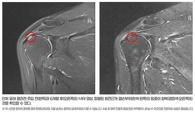 (사진제공=힘찬병원)