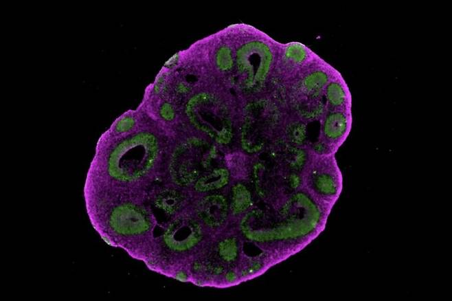 인간 뇌 오가노이드 단면. 신경 전구세포(초록색)와 신경세포(자홍색)가 보인다. 산드라 셰퍼스·위르겐 크노블리히 연구실·IMBA 빈 바이오센터 제공