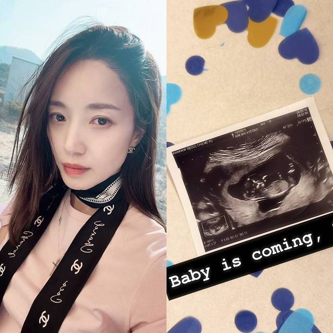 ▲ 김민경. 출처| 김민경 SNS