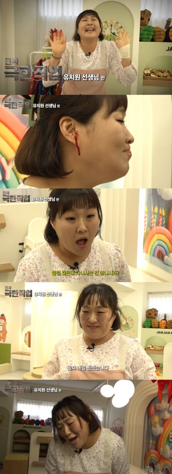 이수지 '핫이슈지'