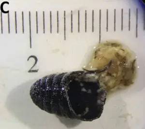 사람의 코에서 발견된 양코파리 번데기. 사진= Ilias P. Kioulos, Emmanouil Kokkas, Evangelia-Theophano Piperak