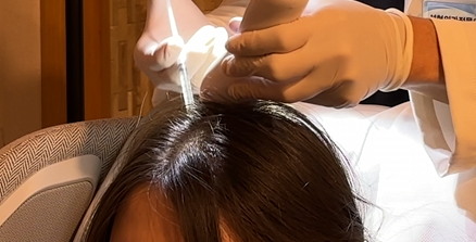 보톡스를 두피에 직접 주입하는 장면. 보톡스는 '두피'라는 국소적인 환경을 개선하는데 쓰이며 전신 부작용이 적다. 다만 탈모 치료에 있어 보조치료 이상의 의미를 가지기 어렵다. [나의 탈모 해방일지]