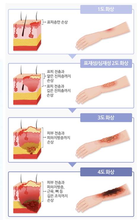 /사진=질병관리청 국가건강정보포털