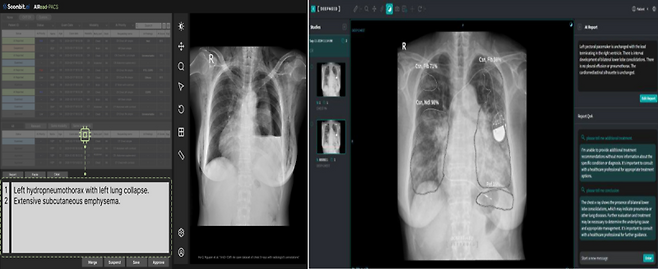 숨빗AI 'AIRead-CXR'와 딥노이드 'M4CXR'/(사진=각 사)