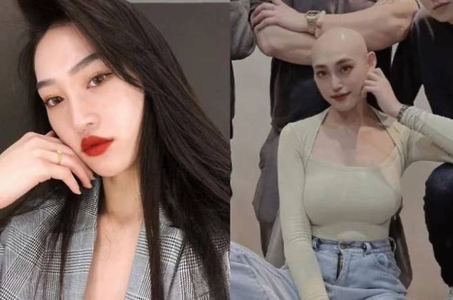 대만의 20대 유명 인플루언서가 림프종을 근육통으로 오인해 치료 시기를 놓치고 사망한 사연이 전해졌다./사진=더 선