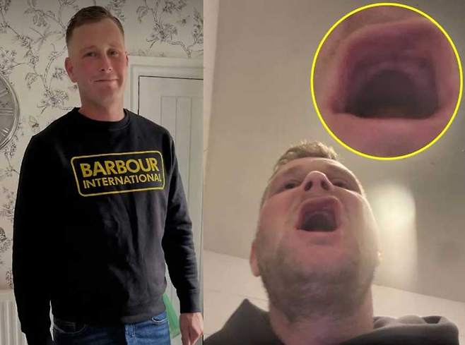 오토바이 사고 후 망가진 치아를 치료하던 중 비용 부담을 줄이려 해외에서 치료를 받았다가 치아를 다 잃게 된 한 남성의 사연이 전해졌다.​/사진= 더선