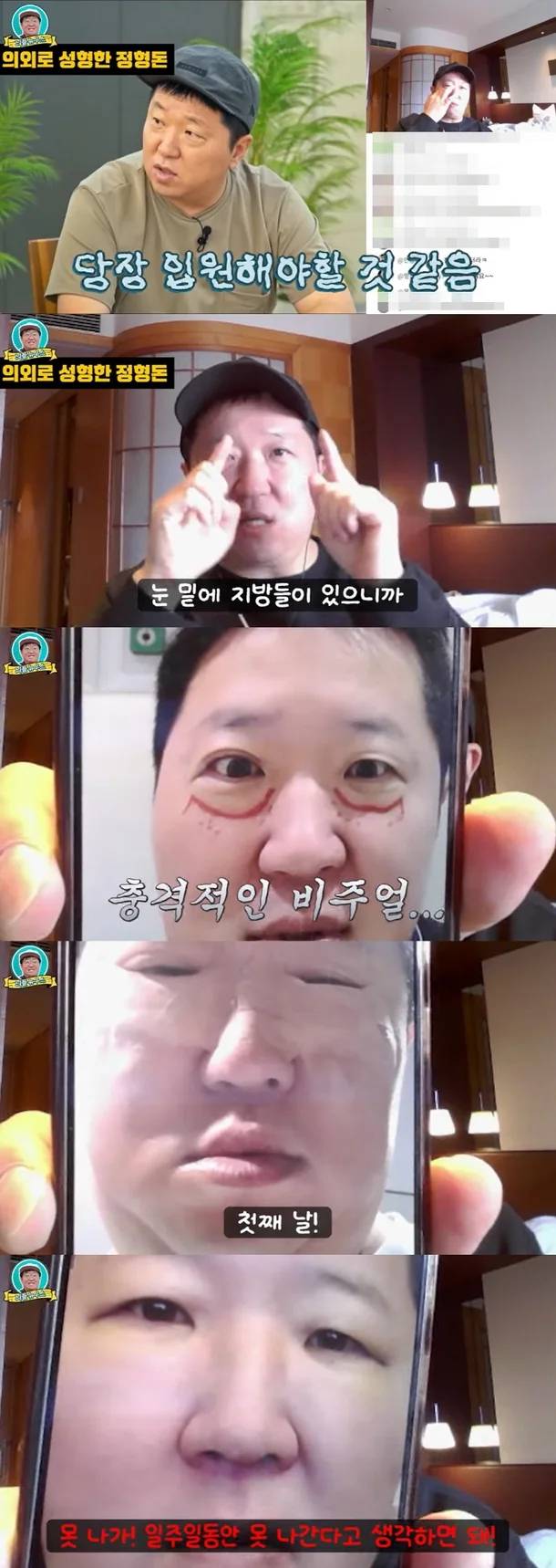 유튜브 ‘뭉친TV’ 정형돈.