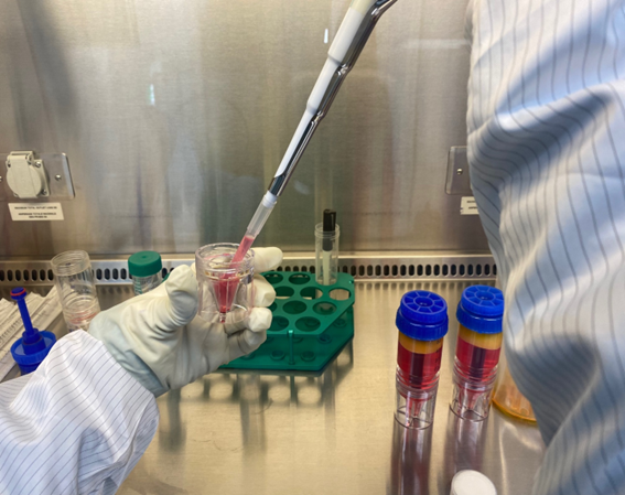 ▲연세사랑병원 줄기세포-재생의학 연구진이 SVF를 분리하고 있다. 사진=연세사랑병원