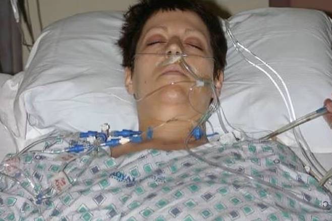 석면이 묻은 아버지의 외투를 입었던 것이 계기가 돼 수십 년 뒤 암 진단을 받은 여성의 사연이 전해졌다./사진=미러