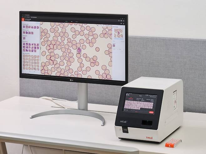 노을이 우간다에 공급하기로 한 인공지능(AI) 기반 말라리아 솔루션(miLab MAL). 노을 제공