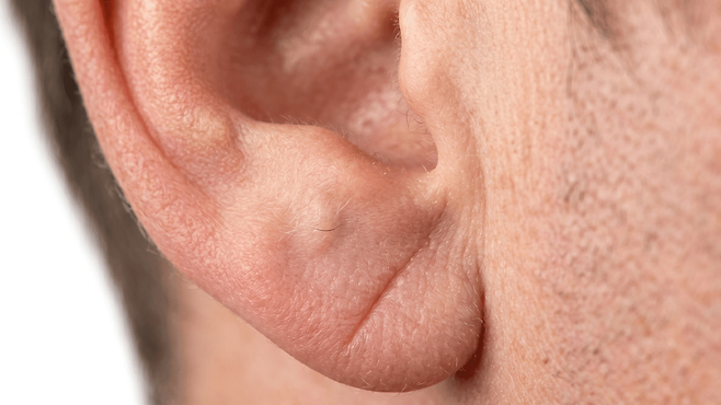 심장 혈관 이상, 피부로 나타난다? 귓불과 눈가 징후 확인해야｜출처: 클립아트코리아