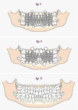 4세(젖니), 6세(젖니+영구치), 12세(영구치)의 치아 개수와 구조 /전승준