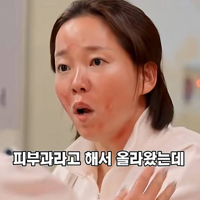 SNL코리아 시즌 8의 코너 '스마일클리닉'에서 아토피 환자(배우 정이랑)가 피부과를 찾았으나 진료가 불가능하는 설명을 듣고 분통을 터뜨리고 있다. 사진 유튜브 캡처