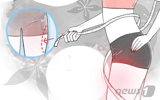 비만뿐만 아니라 급격한 체중감소도 담낭, 담석 발생의 위험인자이므로 급격한 체중 감량을 자제하고 평소 규칙적인 운동을 통해 적절한 체중을 유지하는 게 좋다.