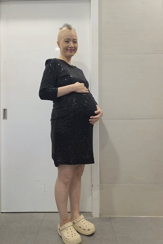 ▲ 사진 | 안영미 SNS