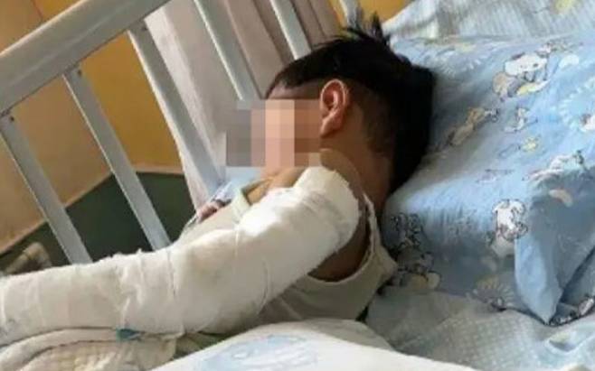 11층에서 떨어진 뒤 입원한 아이. 중국 온라인 커뮤니티 소후 캡처