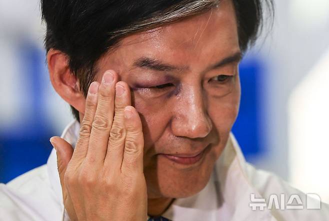 [평택=뉴시스] 정병혁 기자 = 경기 평택을 국회의원 재선거에 출마하는 조국 조국혁신당 후보가 14일 경기 평택시선거관리위원회에 후보자 등록을 하며 멍 든 눈을 만지고 있다. 조 후보는 "일정 중 이마를 문에 세게 부딪히는 작은 사고가 났다"고 밝혔다. 2026.05.14. jhope@newsis.com
