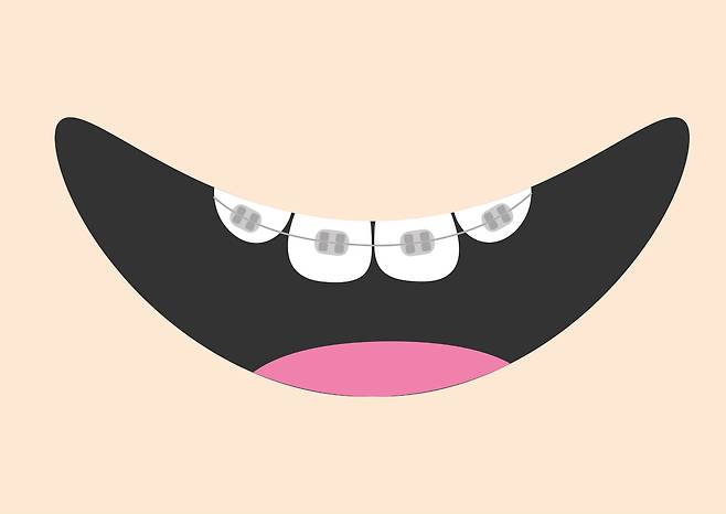 Mouth with tooth braces and tongue. Smiling face. Healthy teeth brace. Body part. Cute cartoon character. Oral dental hygiene Children teeth care icon. Baby background. Flat design Vector illustration