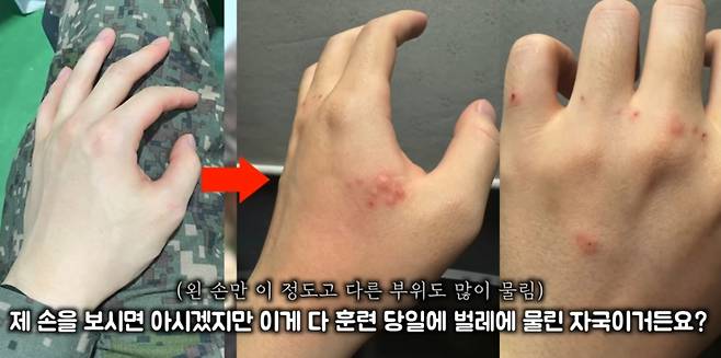 김토르는 벌레에 물린 손 사진을 첨부하면서 "이게 다 훈련 당일 벌레에 물린 자국이다. 진지에 모기도 많고 벌레도 정말 많아 대기하는 것 자체가 힘들었다. 다른 진지에서는 영관급 장교들이 방탄 벗으면 퇴소시킨다고 위협했다더라"라고 주장했다.   김토르는 "저는 이번 훈련을 통해 대한민국 군대가 왜 욕을 먹는지 알게 됐다. 이런 식으로 몸 상태가 어떨지도 모르는 예비군에게 갑자기 30도 날씨에 강도 높은 훈련을 진행하면 사고가 발생할 거라는 사실을 몰랐을까"라고 지적했다. /사진=김토르 유튜브 채널 캡처