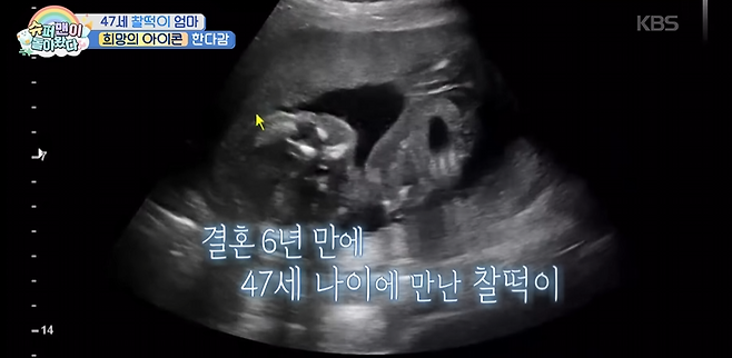 유튜브 채널 ‘KBS Entertain’ 영상 캡처.