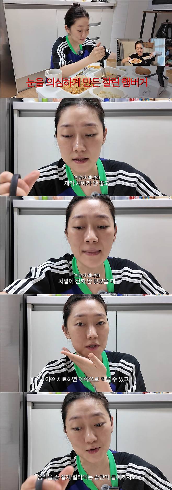 Actress Park Kyung-hye revealed a habit she hasnt been able to break even after undergoing jaw surgery.On the 7th, a video titled Repairing the Under-Sink Cabinet and Window Screen! Plus, Kyung-hyes Scalp Care After Getting Frustrated was posted on the YouTube channel Kyunghye Vollae.Park Kyung-hye decided to repair the sink base cabinet she had worked on with Lee Chan-hyung on MBCs I Live Alone. After the repair, looking exhausted, Park Kyung-hye turned the camera back on and said, Theres something Ive really come to realize while living on my own. Cleaning and repairs never end when you live alone, and you really have to be diligent, she said. As Ive been getting this tired, Ive had a thought. Taking care of this house is so important. But just for today, Im going to take care of myself, so Im going to make today a day to properly pamper myself, she added, deciding to order some delicious food after her scalp care.Before finishing her scalp care, Park Kyung-hye said, As I mentioned, Im living a luxurious life on my own, so I want to eat steak. I rarely order delivery food, but just for today, I want to treat myself to something truly luxurious and delicious, she said, and with a flutter of excitement, she ordered steak and pasta.While cutting the steak into small pieces, Park Kyung-hye remarked, It just occurred to me while cutting this steak—in the bathroom episode, I cut up a hamburger to eat. In response, the PD said, Please explain that, and Park Kyung-hye replied, I always cut my hamburgers into pieces.Explaining the reason, Park Kyung-hye said, When my teeth were in bad shape and my bite was really off, I had a lot of dental work done. Whenever I had one side treated, I could eat on the other side, but soon after the treatment was finished, the other side would start giving me trouble, so I often had to chew on just one side. Thats when I developed the habit of cutting my food into small pieces, she explained, adding, Even though my teeth are aligned properly now, I still find myself cutting my food into small pieces.Meanwhile, Park Kyung-hye previously revealed on the 2017 MBC variety show Radio Star that she had undergone orthognathic surgery. Park Kyung-hye explained, My teeth are small. Because of my malocclusion, my teeth broke too quickly. The doctor told me my teeth were weak and that Id need dentures by my 30s, so I ended up getting orthognathic surgery, she explained.She noted that her post-surgery appearance looked so natural that even those close to her didnt notice, adding with a wry smile, Even the directors Id worked with in the past didnt know Id had the surgery. And I spent 30 million won on it, which drew laughter from the audience.