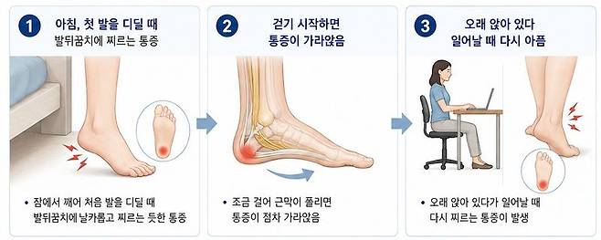 족저근막염의 주요 증상 세 가지. /사진=파이낸셜뉴스 [AI생성 이미지 - ChatGPT]
