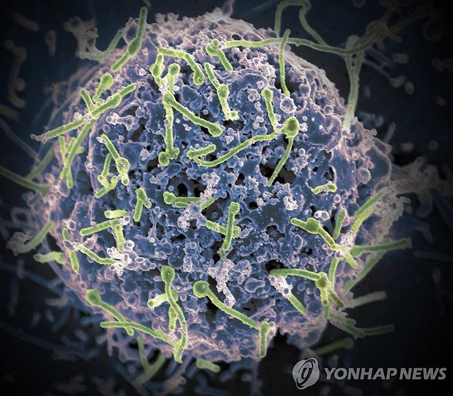 에볼라 바이러스 전자현미경 이미지 [미 국립 알레르기 감염질환 연구소 제공]