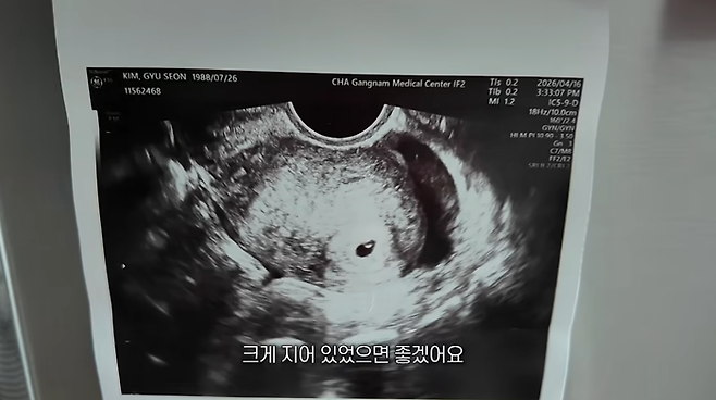 김규선이 공개한 태아 초음파 사진 . 사진 | 김규선 유튜브 채널