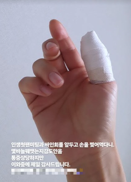 배우 유하나의 부상 관련 이미지. 유하나 SNS 캡처
