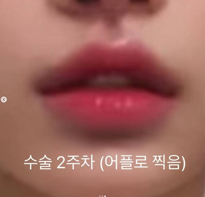 /사진=맹승지 SNS