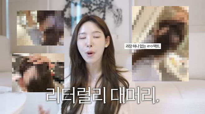 Lee Na-yeon, a JTBC sports announcer and cast member of Transfer Love 2, revealed on her YouTube channel that she experienced severe hair loss as a side effect of her hair transplant surgery. Lee Na-yeon said she suffered significant emotional distress after the surgery due to massive hair loss at the back of her head, but she has now recovered to a large extent.She underwent a non-surgical long-hair transplant to correct her receding hairline, but starting ten days after the procedure, she began losing handfuls of hair from the back of her head—not from the transplanted area. Although she visited several hospitals without finding a clear cause, she described the situation at the time as hellish and opened up about her emotional state, revealing that she would often shed tears while looking in the mirror.Based on this experience, Lee Na-yeon emphasized the importance of managing scalp health before surgery to those considering a hair transplant. She also urged people to make careful decisions, noting that such side effects could stem from complex factors—such as an individuals immune response—rather than being due to the clinics negligence.